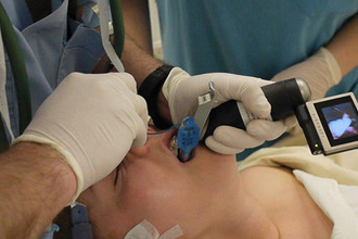 Intubarea traheala - utilaje si indicatii de utilizare