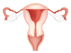 Cum se dezvolta rapid fibrom uterin