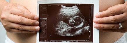 Cum și când se poate determina sexul unui copil nenăscut cu ultrasunete