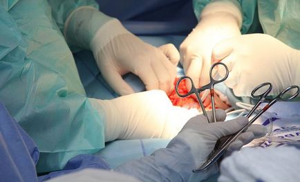 Cum să se pregătească pentru anestezie și chirurgie
