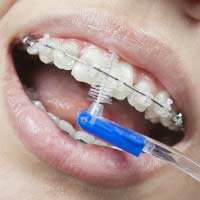 Cum de a folosi ata dentara (ata), foto, video