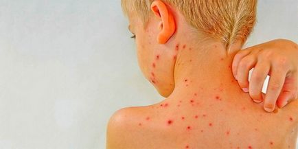 Cum alergii ale pielii, pete roșii și tratarea acestora