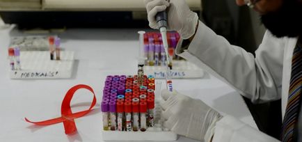 Cum de a ucide orice indicatori HIV-temperatură afectează în mod negativ retrovirus