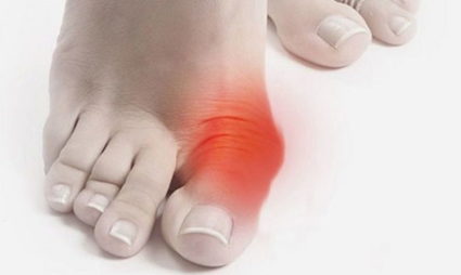 Cum de a elimina os și tratamente populare tradiționale picior