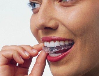 Cum să îndreptați dintii la sfaturi de acasă