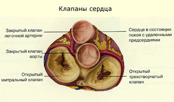 Supape, valvulopatii, mitrala, inima