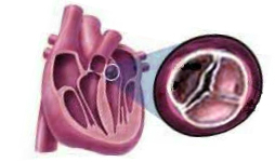 supapa de inima nu se închide până la sfârșitul anului - cauze si simptome
