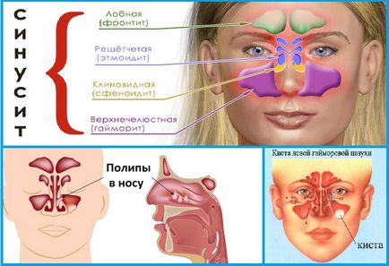 Tomografia computerizata (CT) scanare a nasului și a sinusurilor paranazale pret, foto, video