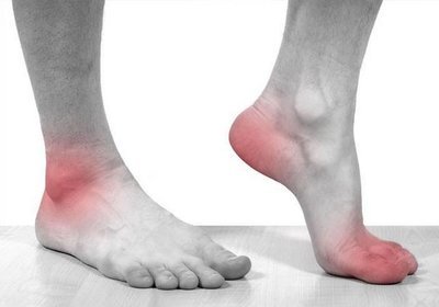 Tratamentul de gută la nivelul picioarelor prin remedii populare