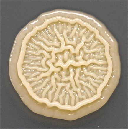 Microbii sub microscop, bacteriile de pe mâinile tale (foto)
