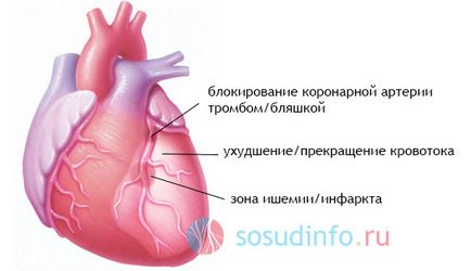 simptome cardiace minore și semne de tratament