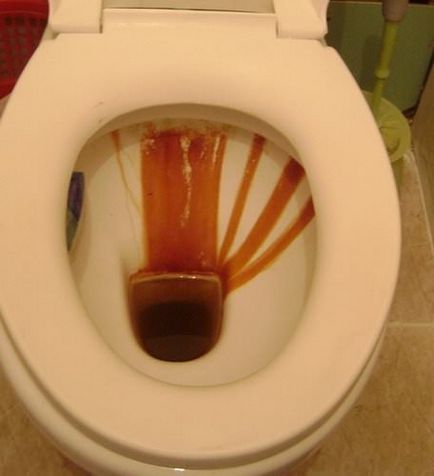 Piatra urinar în toaletă cum să eliminați decât se dizolvă, se spală, instrucțiuni video și foto