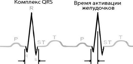 ECG normal - studopediya