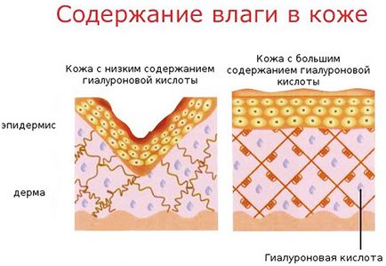 Persoana de piele deshidratata ce să facă, simptome, revizuirea remedii populare, reguli de îngrijire (îngrijire) Persoana de piele deshidratata ce să facă, simptome, revizuirea remedii populare, reguli de îngrijire