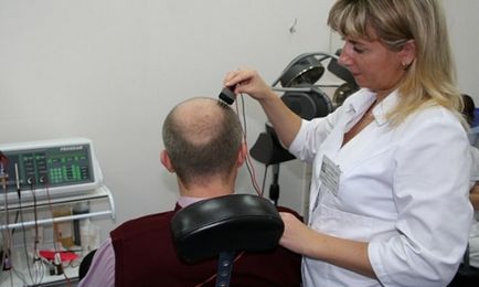 Alopecia areata Tratamentul de masculi de reproducere chelie