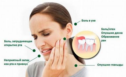Cauze dureri de dinți acute, ce să facă, cum și ce să eliminați