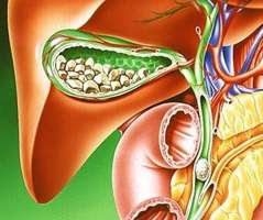 Îmbunătățirea vezicii biliare