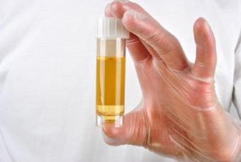 acetonă ridicată în urină a copilului simptome, tratament, cauze