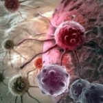 metastaza cancerului, onkostatus