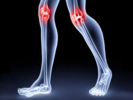 Întinzându ligamentelor genunchiului simptomelor comune și a fișierelor video de tratament