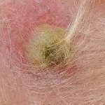 Aureus simptomelor câini și tratamentul de câini, fotografii, modul de a trata infectioase pentru om sau nu, ca (câine) Aureus simptomelor câini și tratamentul de câini, fotografii, modul de a trata infectioase pentru om sau nu, după cum