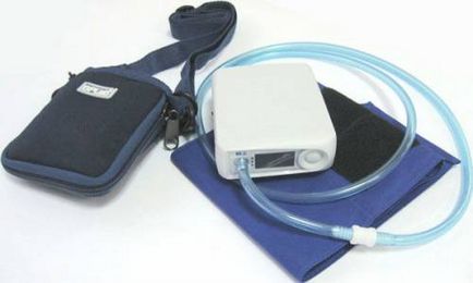 Monitorizarea ambulatorie a tensiunii arteriale (ABPM) și ritmul cardiac