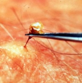 Intepaturi de albina (foto), prim ajutor, simptome și tratament