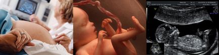 Uzi în timpul sarcinii, raze de sanatate - studiu de ultrasunete - Sănătate raze - Tipul de Cherpakov