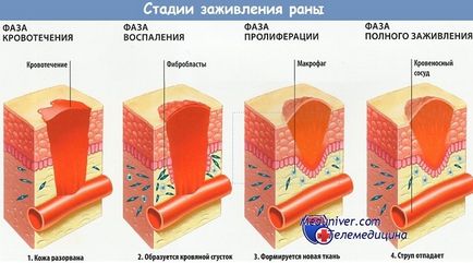 Restaurarea epiteliului rana