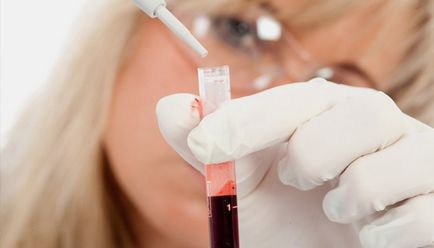 Ce face analiza generală a sângelui dintr-o venă și un deget în copil și adult