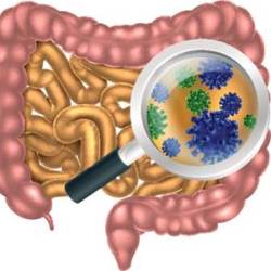 Dysbiosis tratat