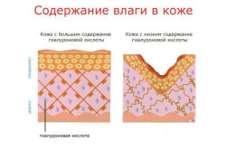 Acidul hialuronic este ceea ce este conținut