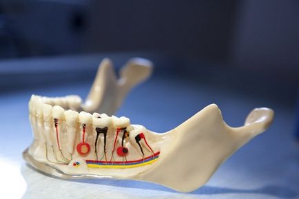 Omoara nervul în dinte decât