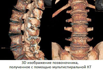 tomografia Sondaj