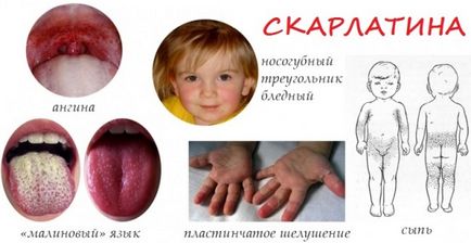 Ce este infectii copilarie