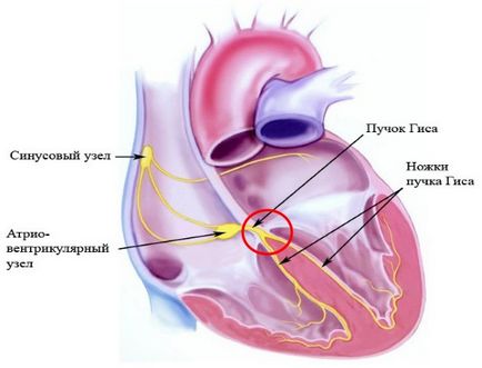 Ce este bloc cardiac incomplet