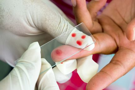 Analiza generală a sângelui de la un deget
