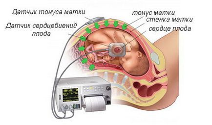 Tonul uterului simptome asemanatoare