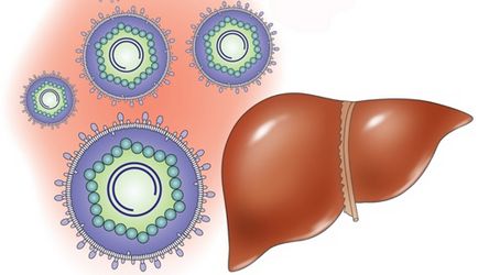 hepatită toxică de la ceea ce