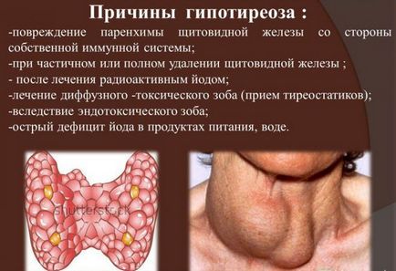 În cazul în care glanda tiroidă este redusă