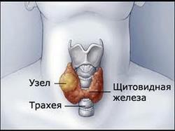 În cazul în care glanda tiroidă este redusă