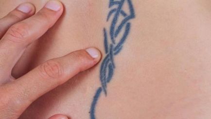 Cum și ce pentru a elimina un tatuaj Cum și ce pentru a elimina un tatuaj
