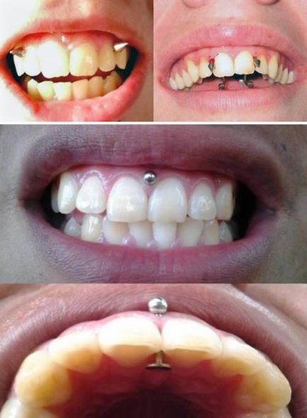 10 cele mai extreme piercing orale și modificări ale corpului