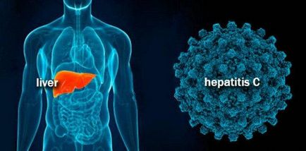 Cât de periculos este hepatita C genotip și ceea ce este cel mai periculos