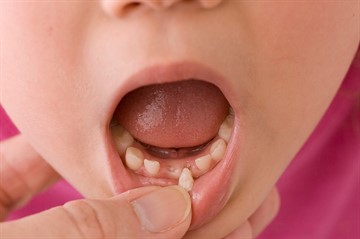 Ce se poate face cu copilul a renuntat la dinti pentru copii - semne și povești