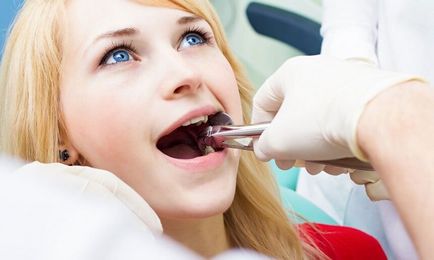 Ce puteți și nu se poate face după extracția dentară restricții și recomandări