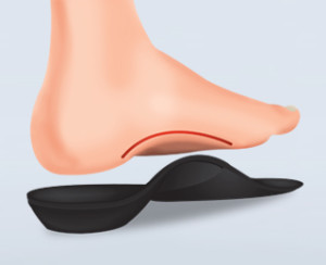 Ce este scobitura în tipurile de pantofi de tălpi interioare ortopedice