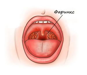 Pe termen lung o durere în gât și nu a trecut cauzele 2 luni