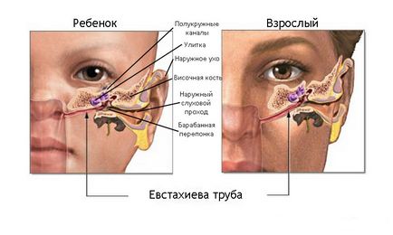 Urechi de infectare - simptomele și tratamentul infecțiilor urechii la om