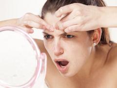 Cum de a elimina rapid un comedon inflamate, acnee tratament la domiciliu